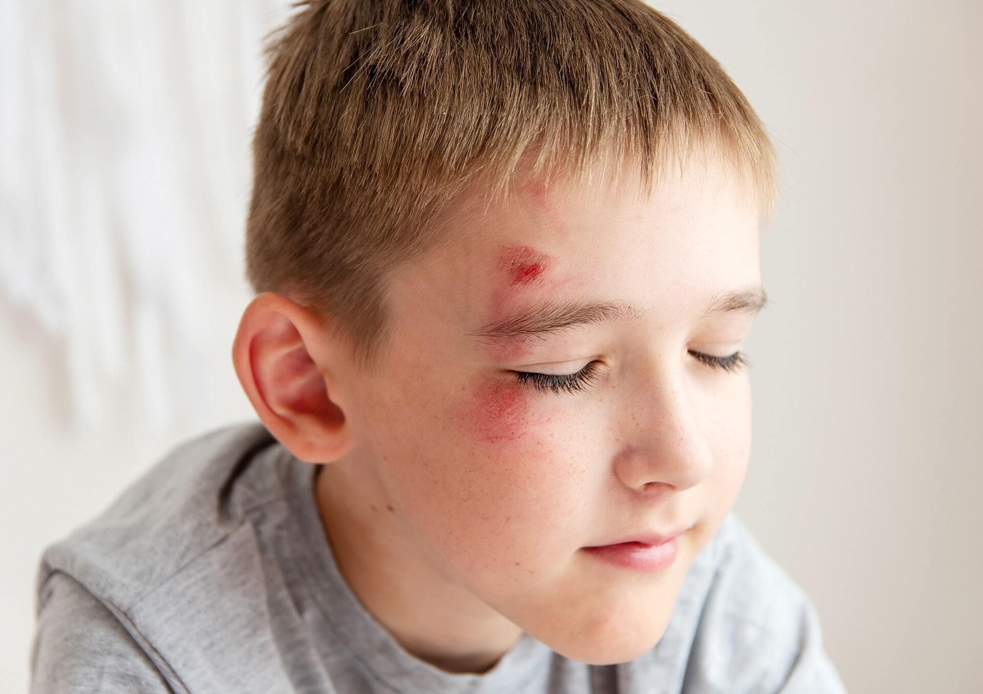 A Better Way to Treat Cuts-min