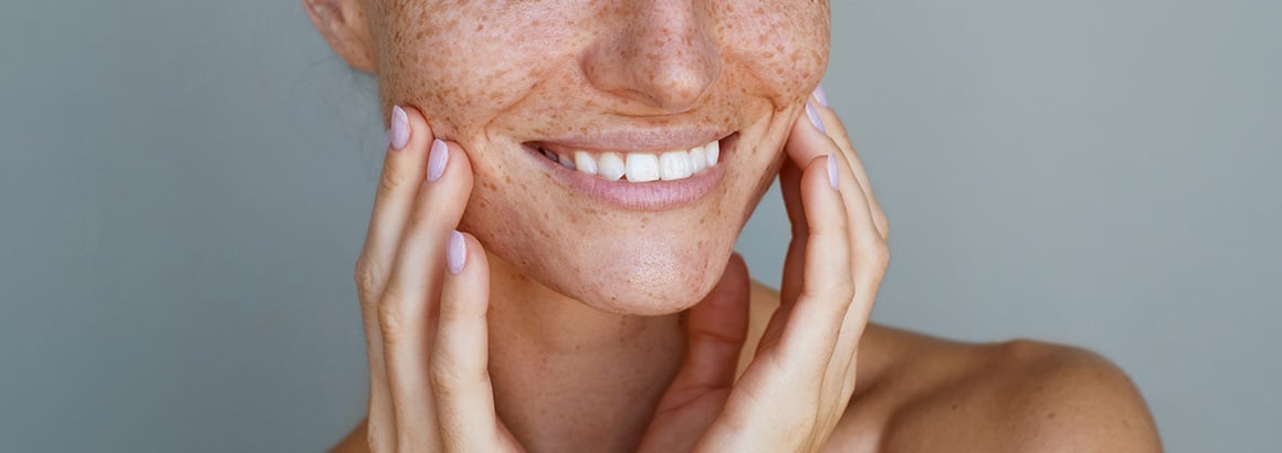 Kybella®