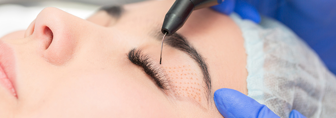 closeup woman eyelid procedure