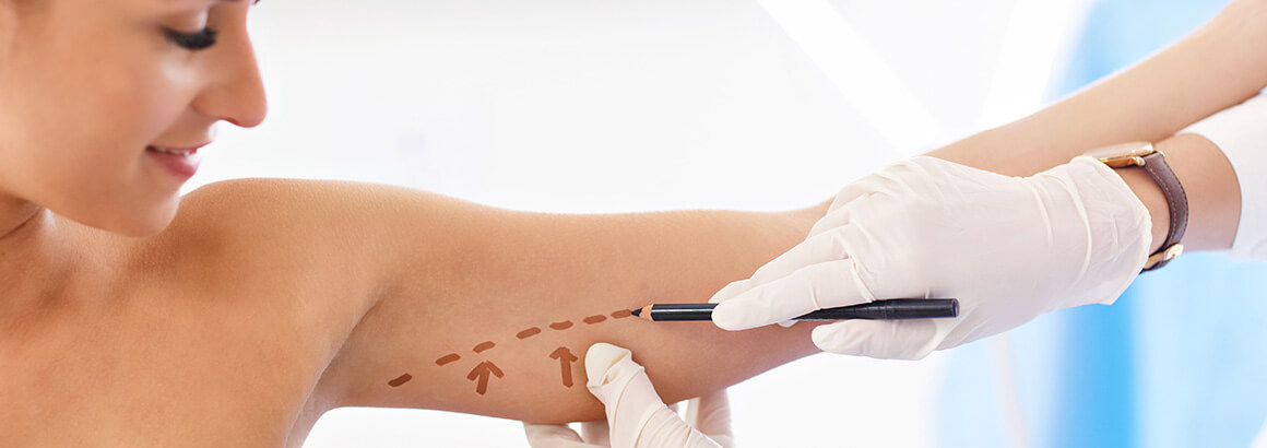 Plastic surgeon making marks on patients arm