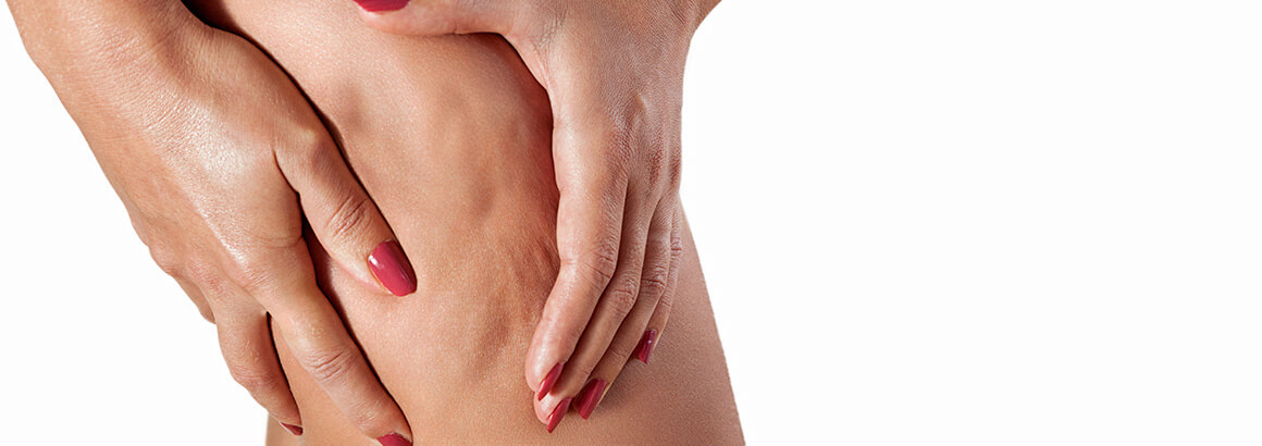 closeup woman with cellulite with red fingernails