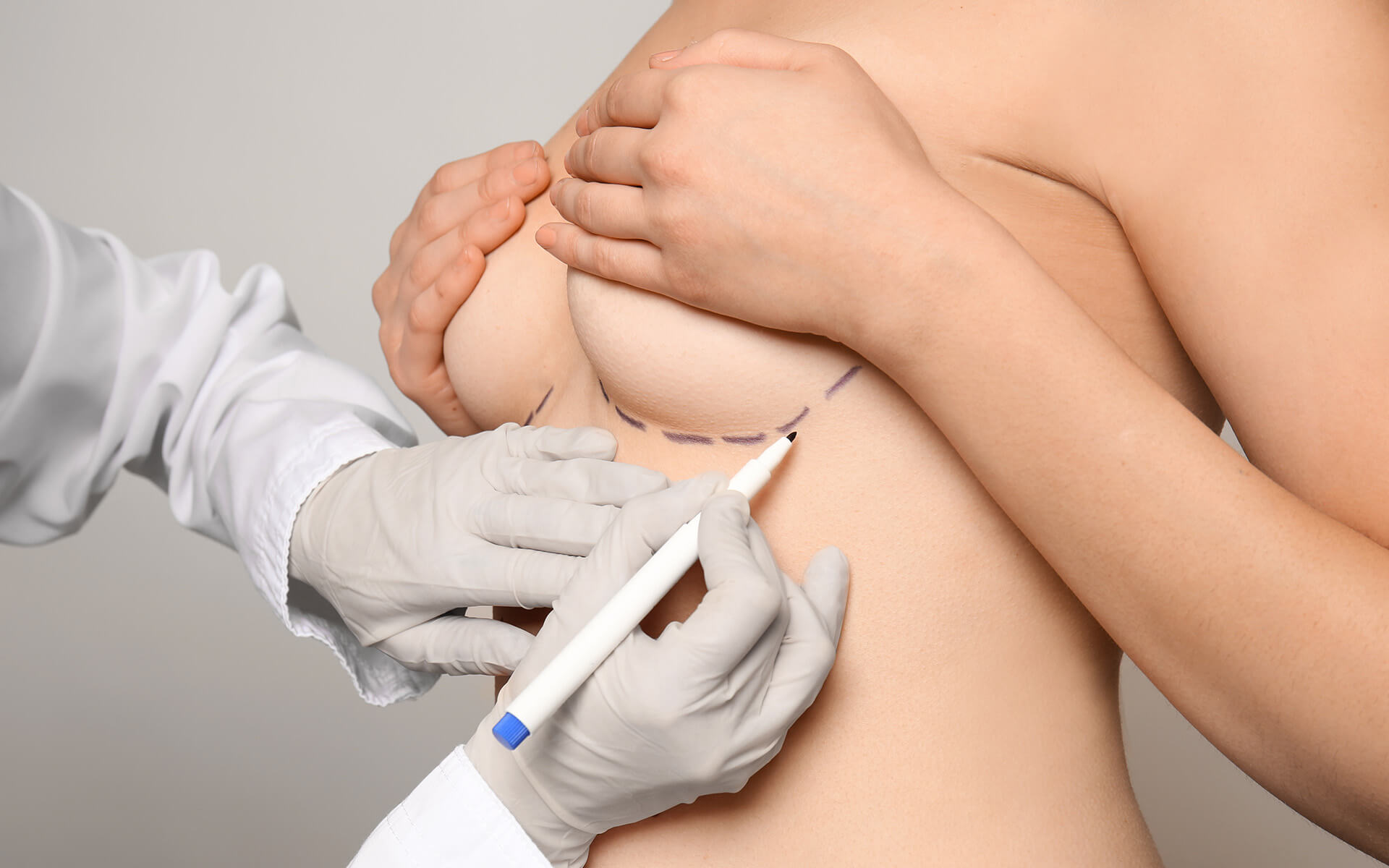 woman receiving markings under breasts