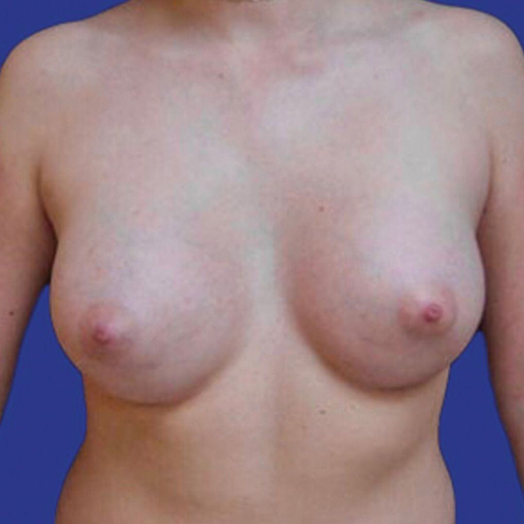 After image