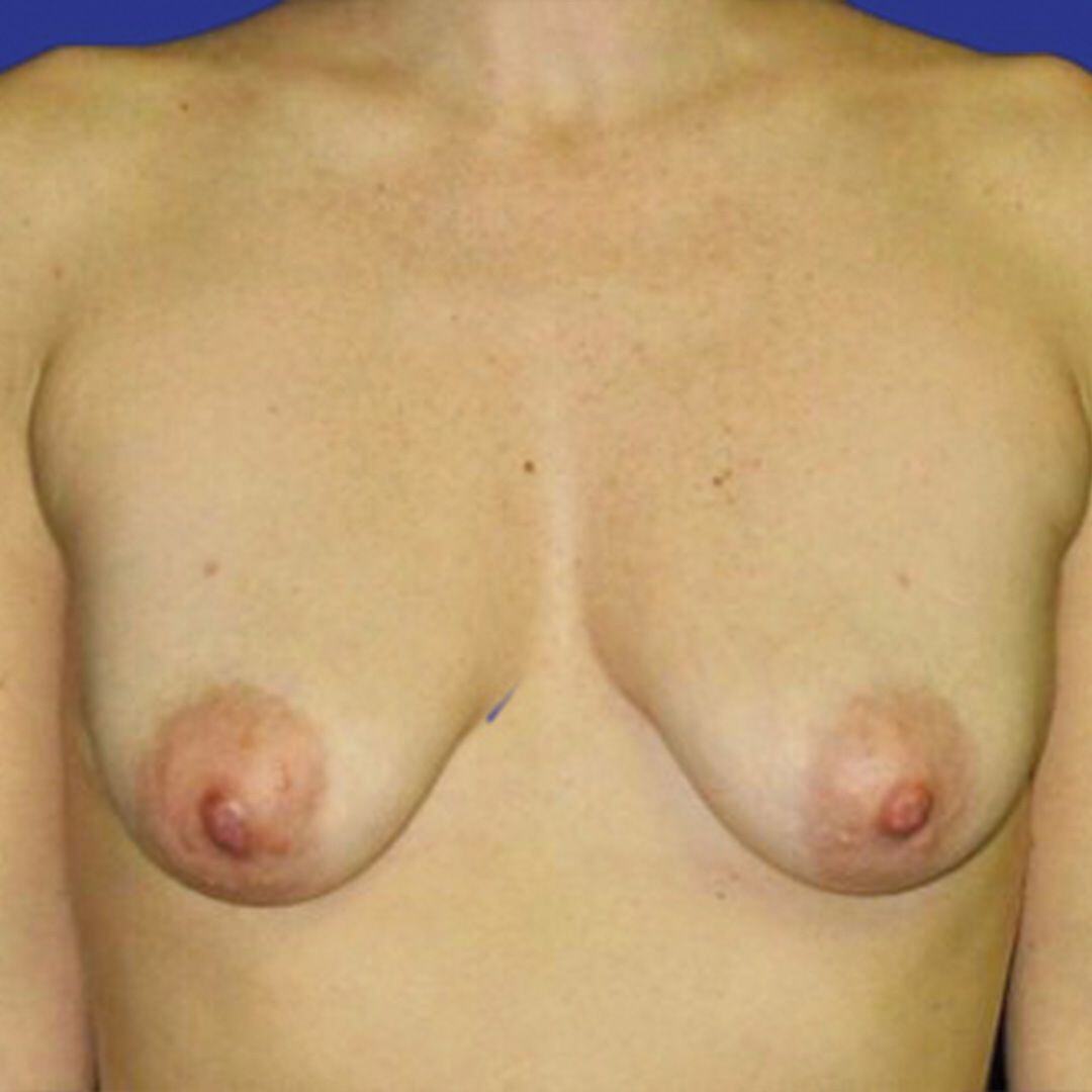 Before image