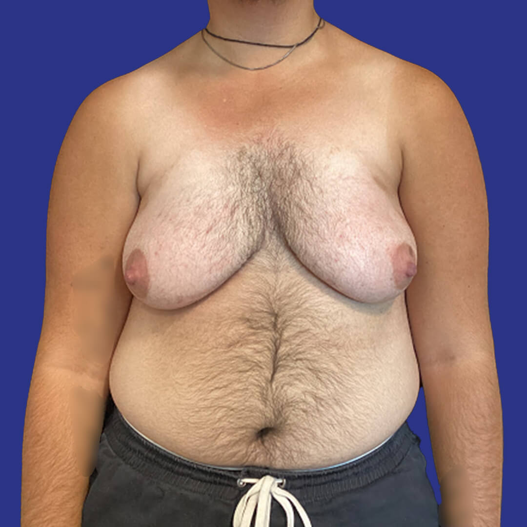 Before image
