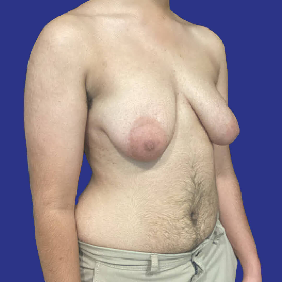 Before image