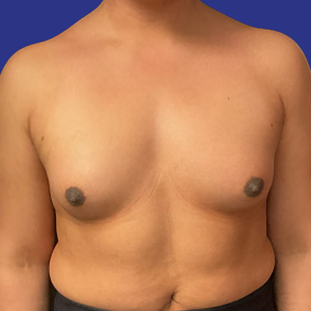 Before image