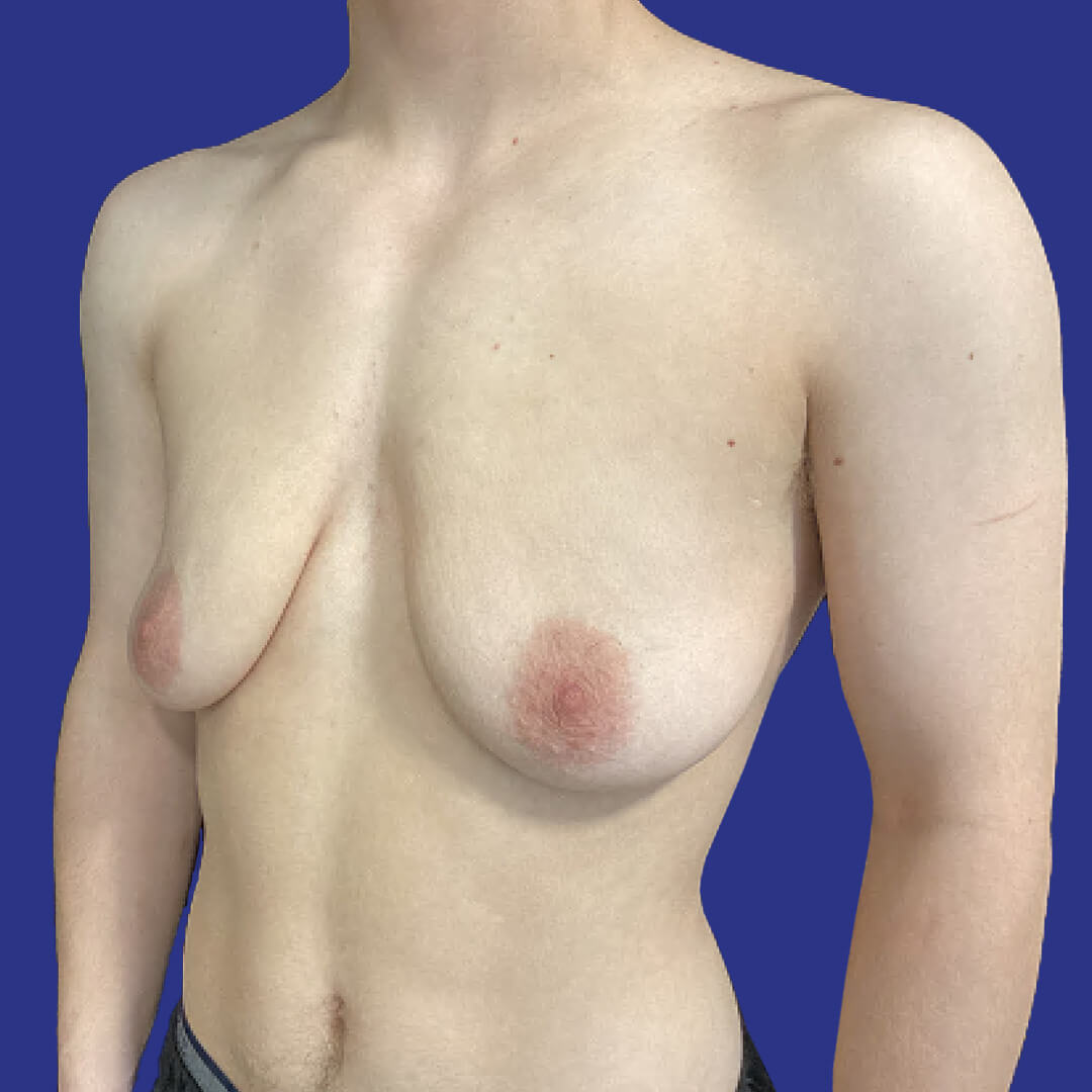 Before image