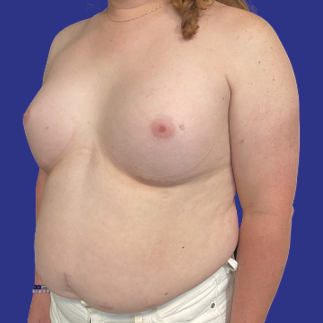 After image