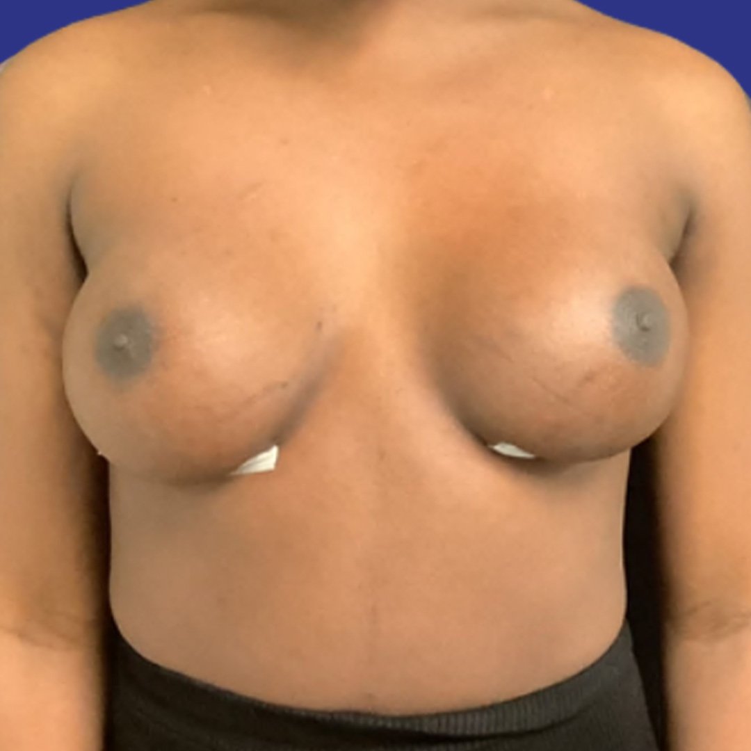 After image