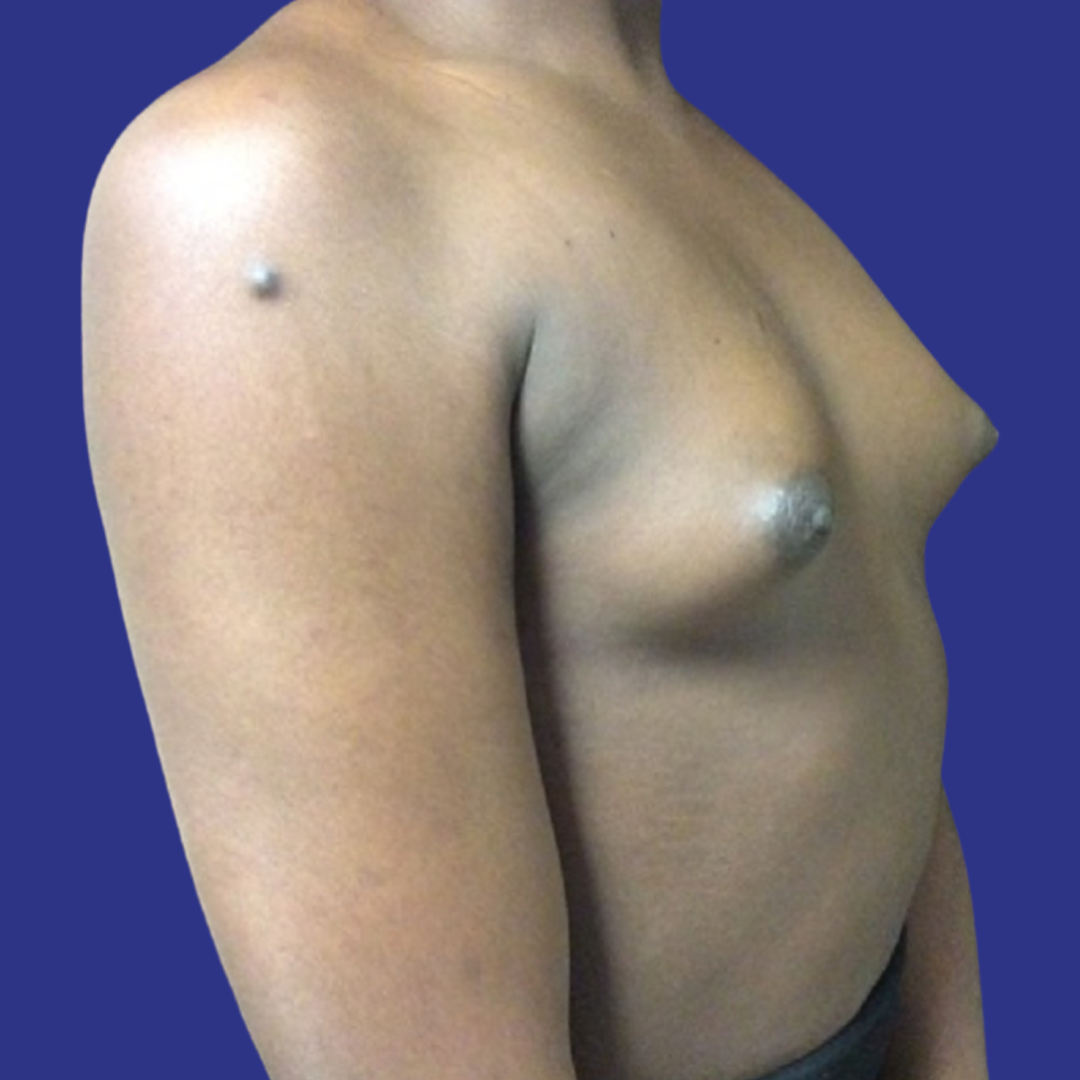 Before image