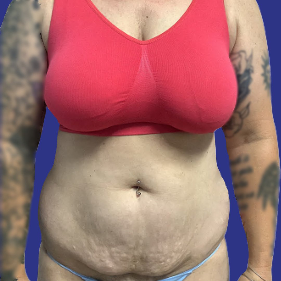 Before image