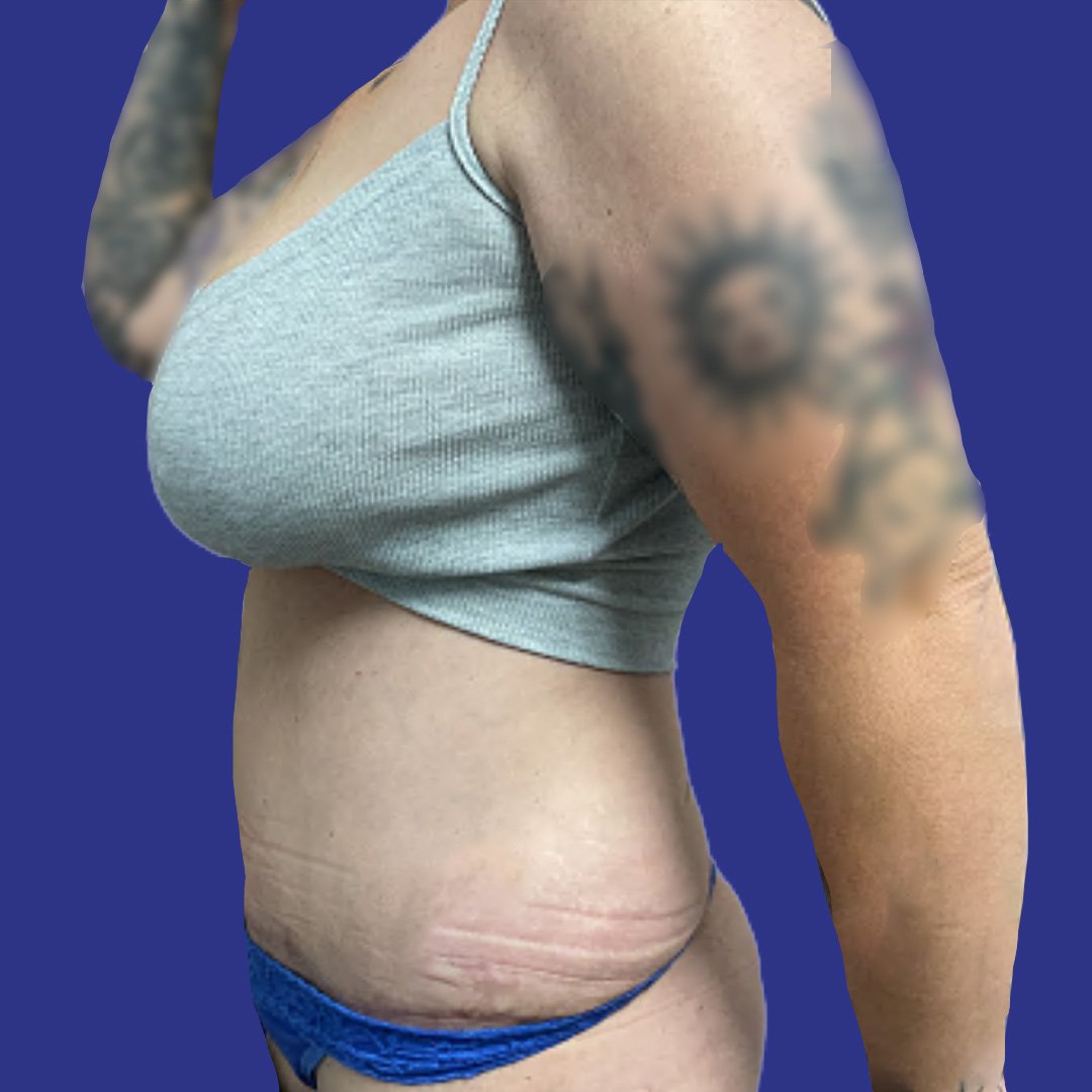 After image