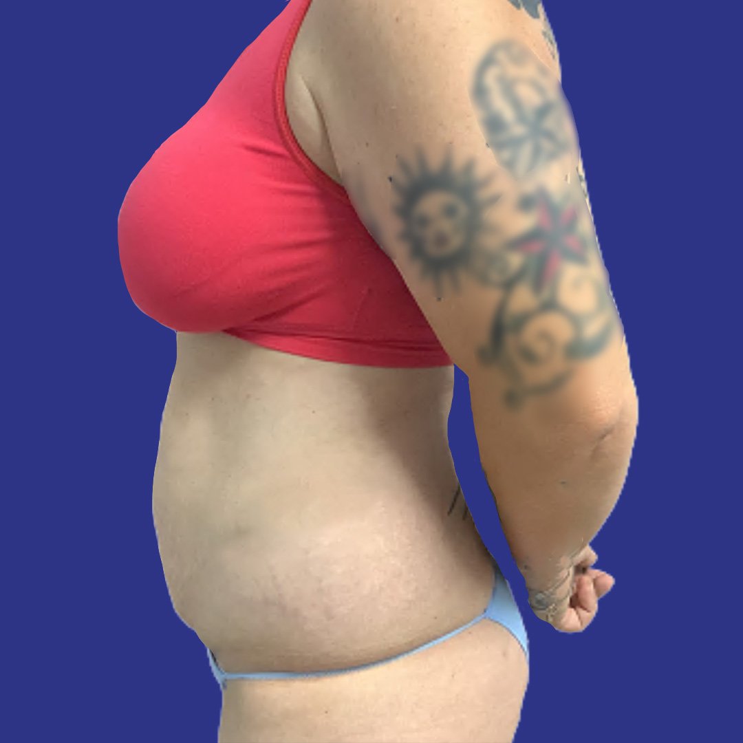 Before image