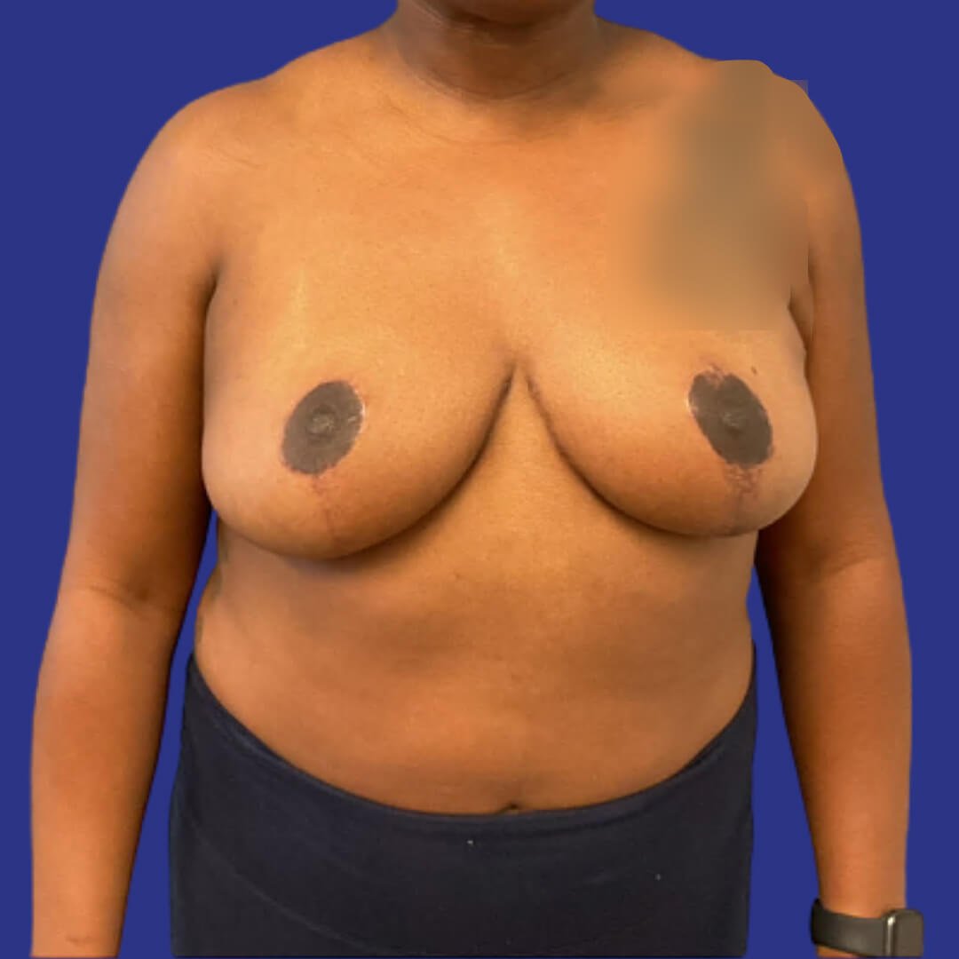 After image