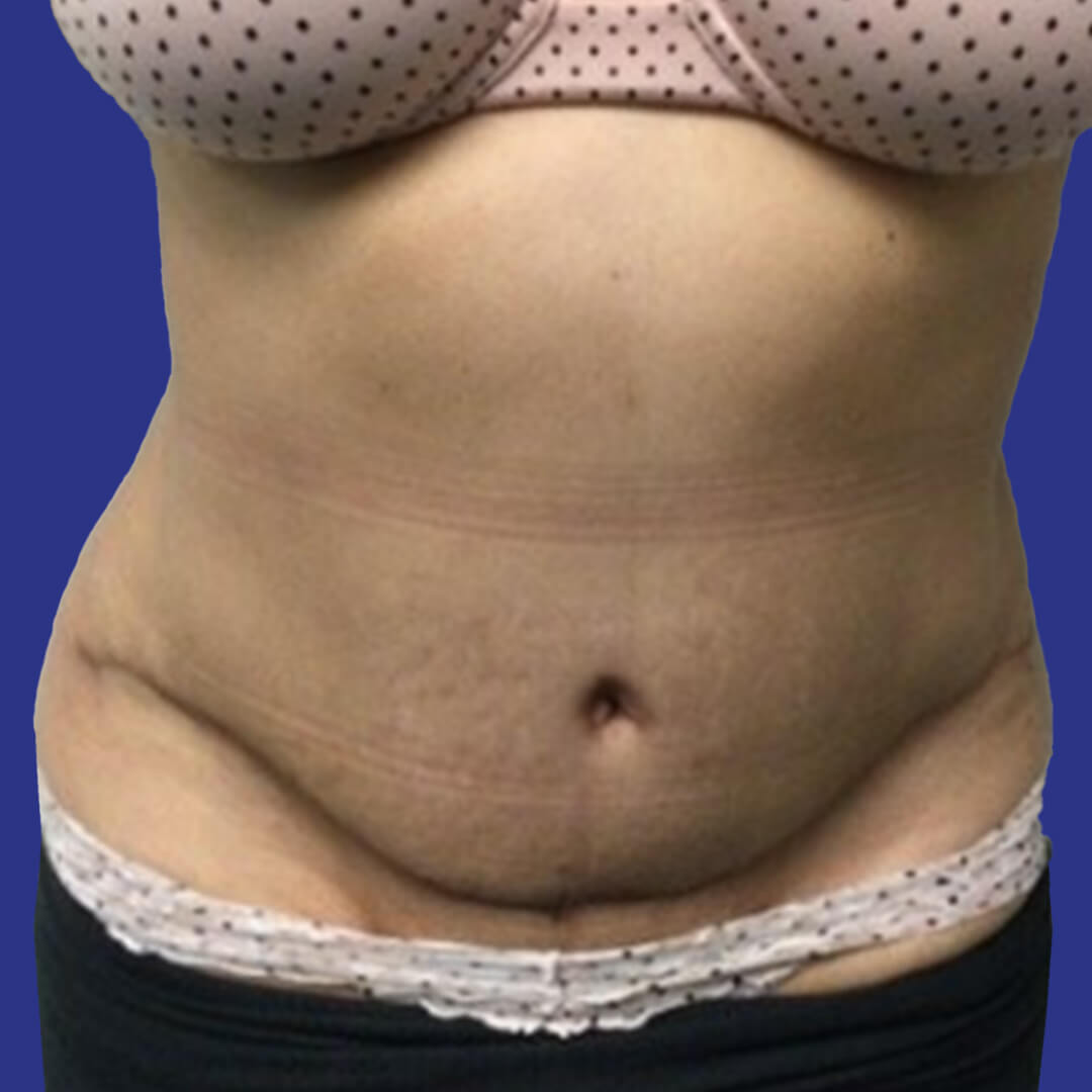 After image