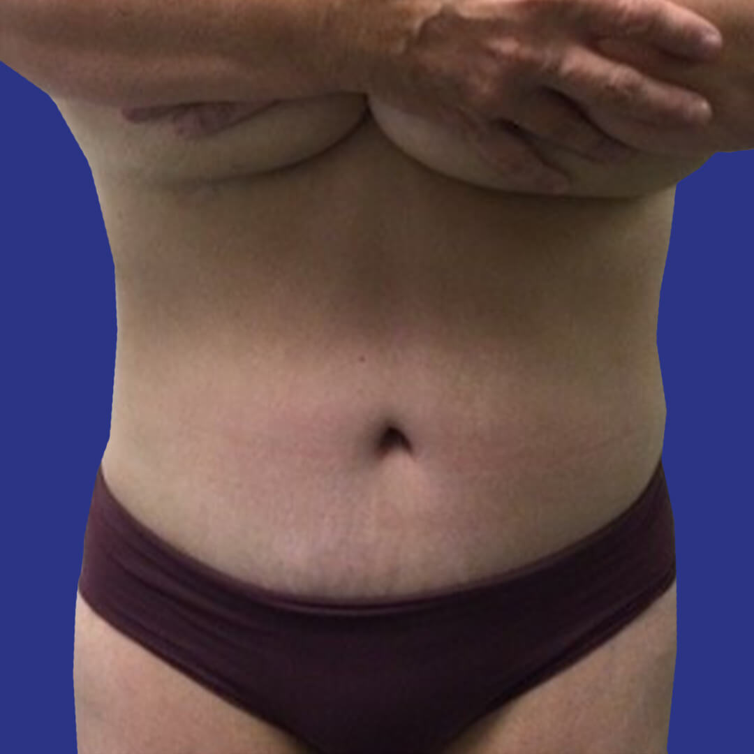After image